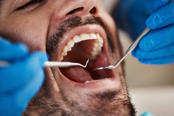 Best Broken or Chipped Tooth Repair in Syracuse, IN
