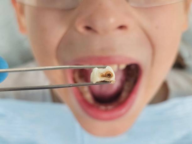 Best Emergency Pediatric Dental Care in Syracuse, IN